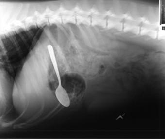 X-ray of a swallowed spoon.